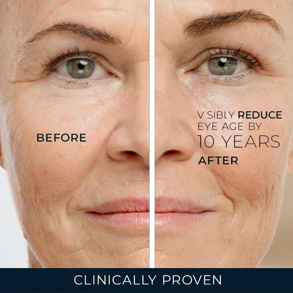 RoC Retinol Correxion Under Eye Cream for Dark Circles & Puffiness, Daily Wrinkle Cream