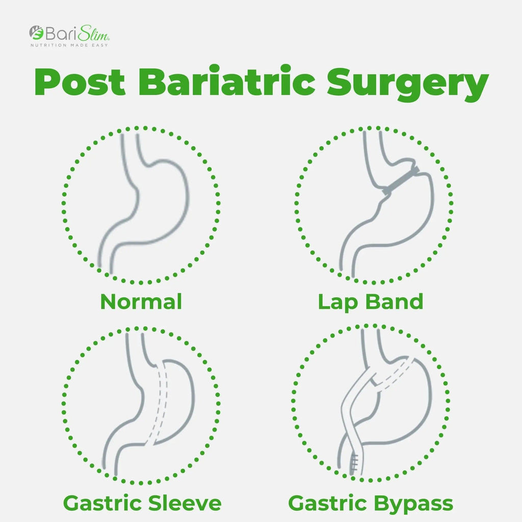 BariSlim Bariatric Calcium Citrate Plus Powder - Formulated for Patients After Weight Loss BariSlim Au supplements