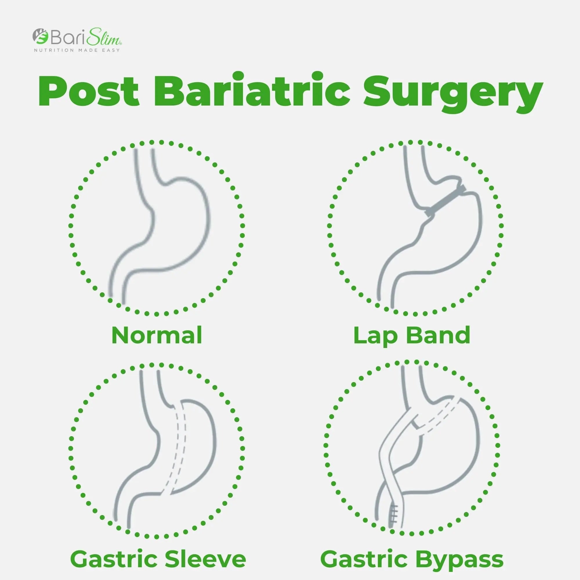 BariSlim Bariatric Calcium Citrate Plus Powder - Formulated for Patients After Weight Loss BariSlim Au supplements