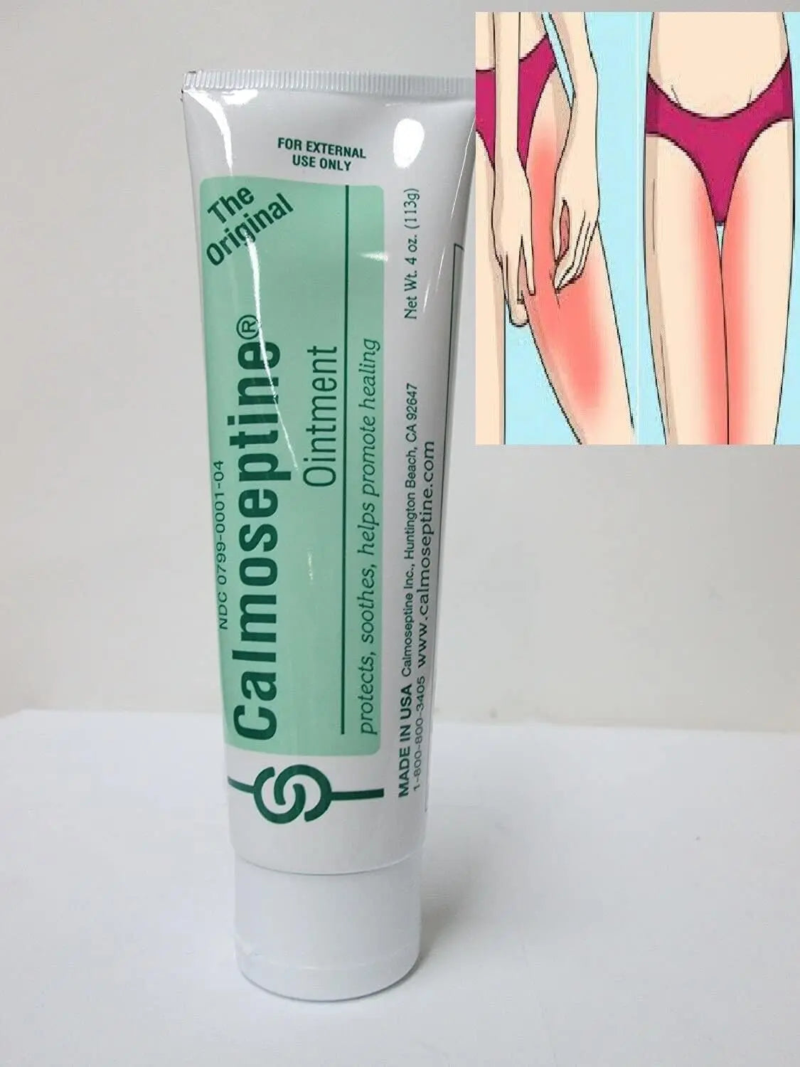 Crema para Infecciones Vaginales Elimina hongos Picazon Irritación Pomada Vagina Generic Au supplements