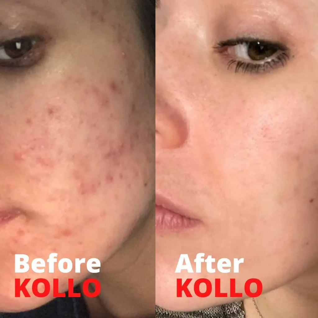 Kollo Premium Marine Collagen Liquid, 10,000 mg - Essential Proteins Collagen Peptides Kollo Au supplements