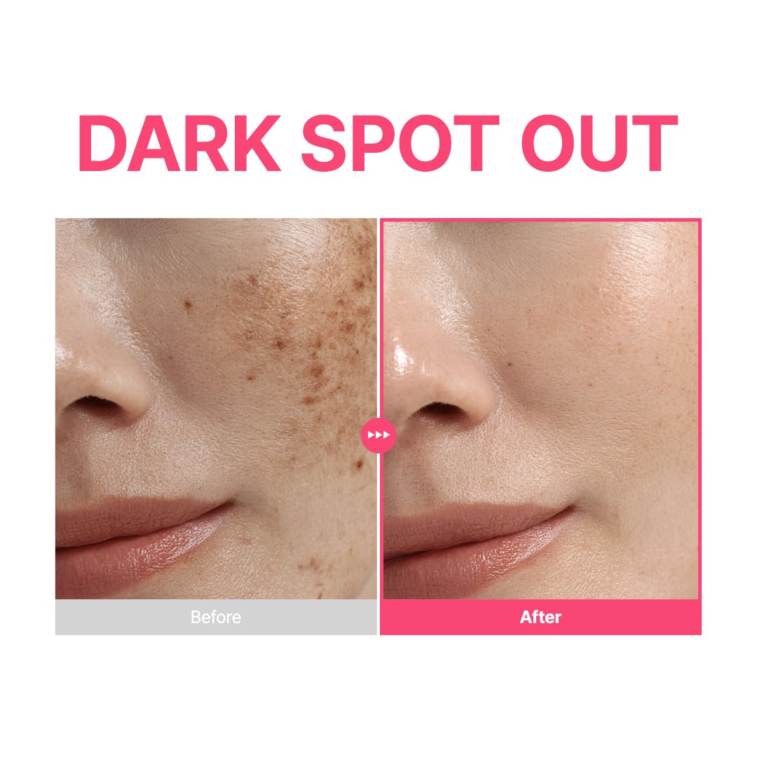 PURITO TXA 6% + Niacinamide 10% + Retinal Facial Serum | for Dark Spots, Hyperpigmentation, Uneven Tone