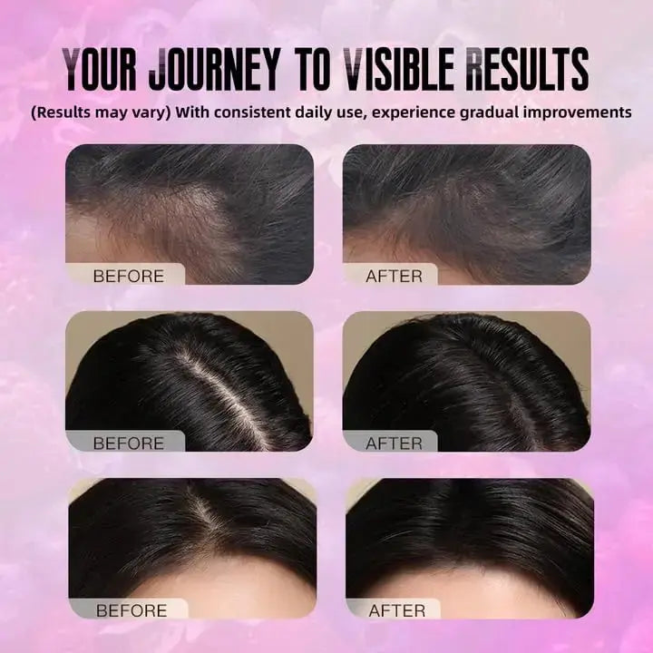 BDQBDQ Lumin Hair Growth Gummies, Infused with Biotin, Vitamins, and Botanical Extracts to Support Healthy Hair Growth and Strength BDQBDQ Au supplements