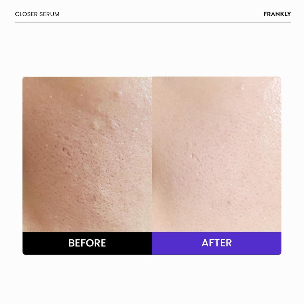 FRANKLY Closer Serum | Pore Minimizer Serum | 9 Peptides, Vegan Collagen, Adenosine, PHA | Korean Pore Minimizer for Glass Skin