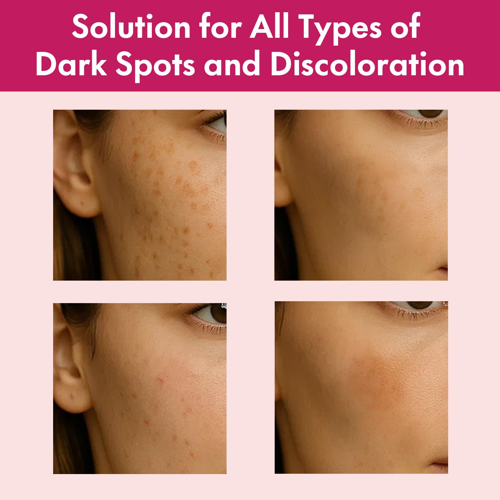 Roseblem Arbutin 7% + Tranexamic Acid 4% Face Cream for Dark Spots & Uneven Skin Tone