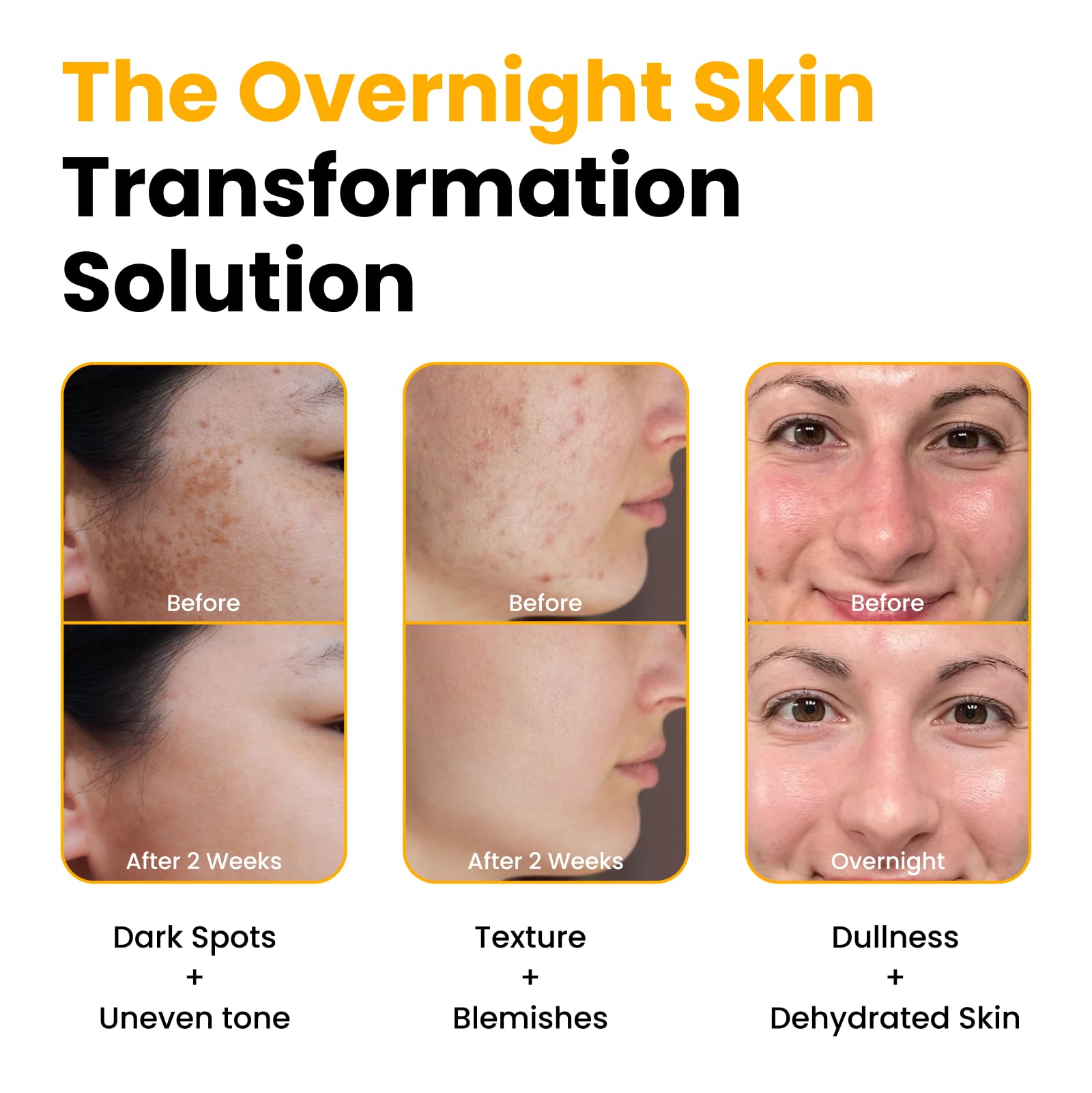 QUIA Turmeric + Kojic Acid Overnight Wrapping Mask – Hydration Mask for Glowing Skin