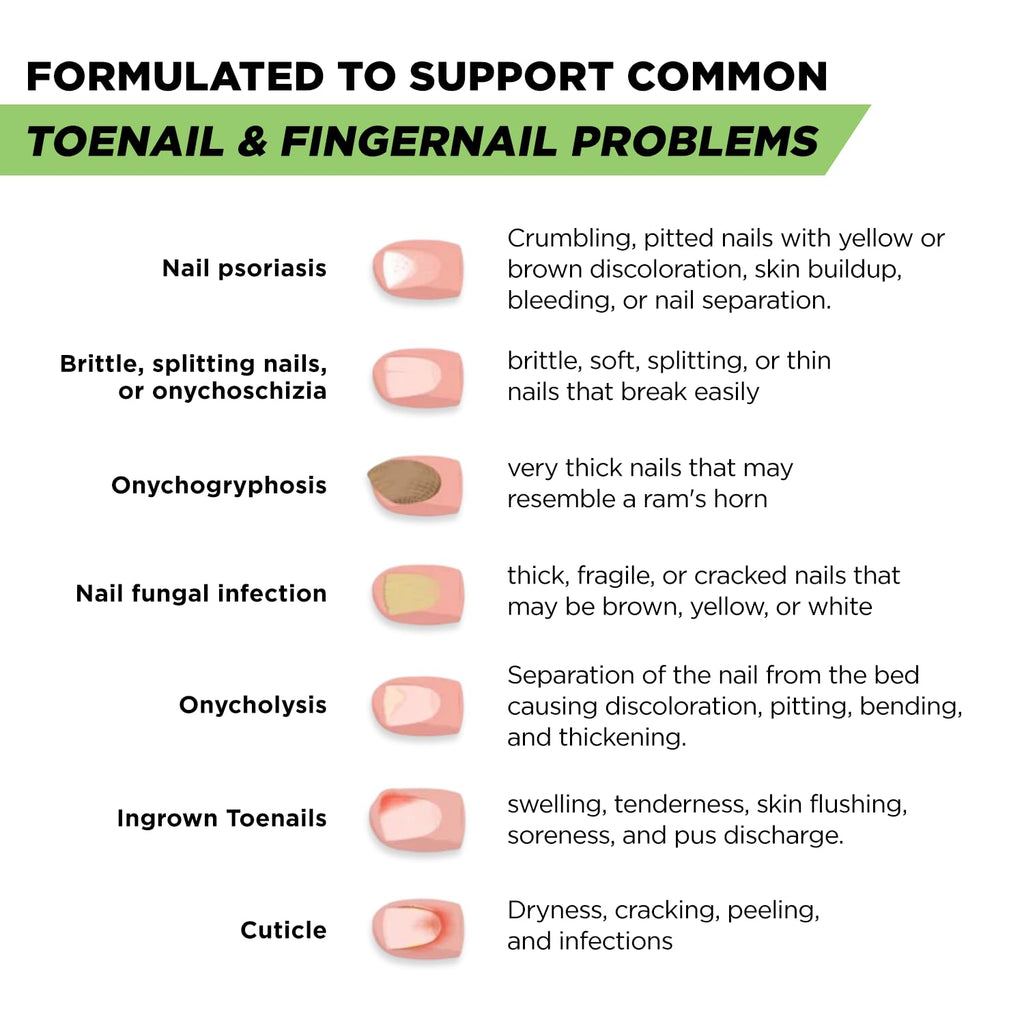 Footcure Antifungal Nail Treatment Pen – Extra Strength Toenail Fungus Treatment