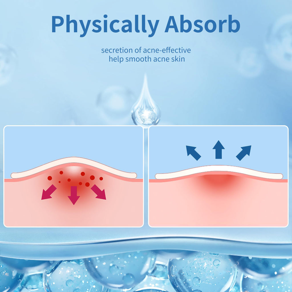 Daolyo Pimple Patches for Face, 4 Size 300 Counts Acne Patches, Hydrocolloid Patches