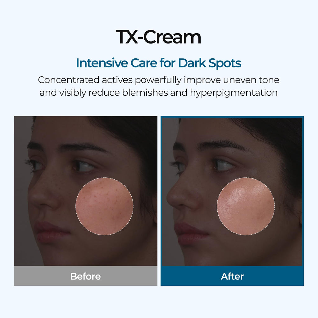 DR.Melaxin TX Tranexamic Acid CREAM | Skin freckle Cream, Blemishes, Anti-pigmetation korean skin care