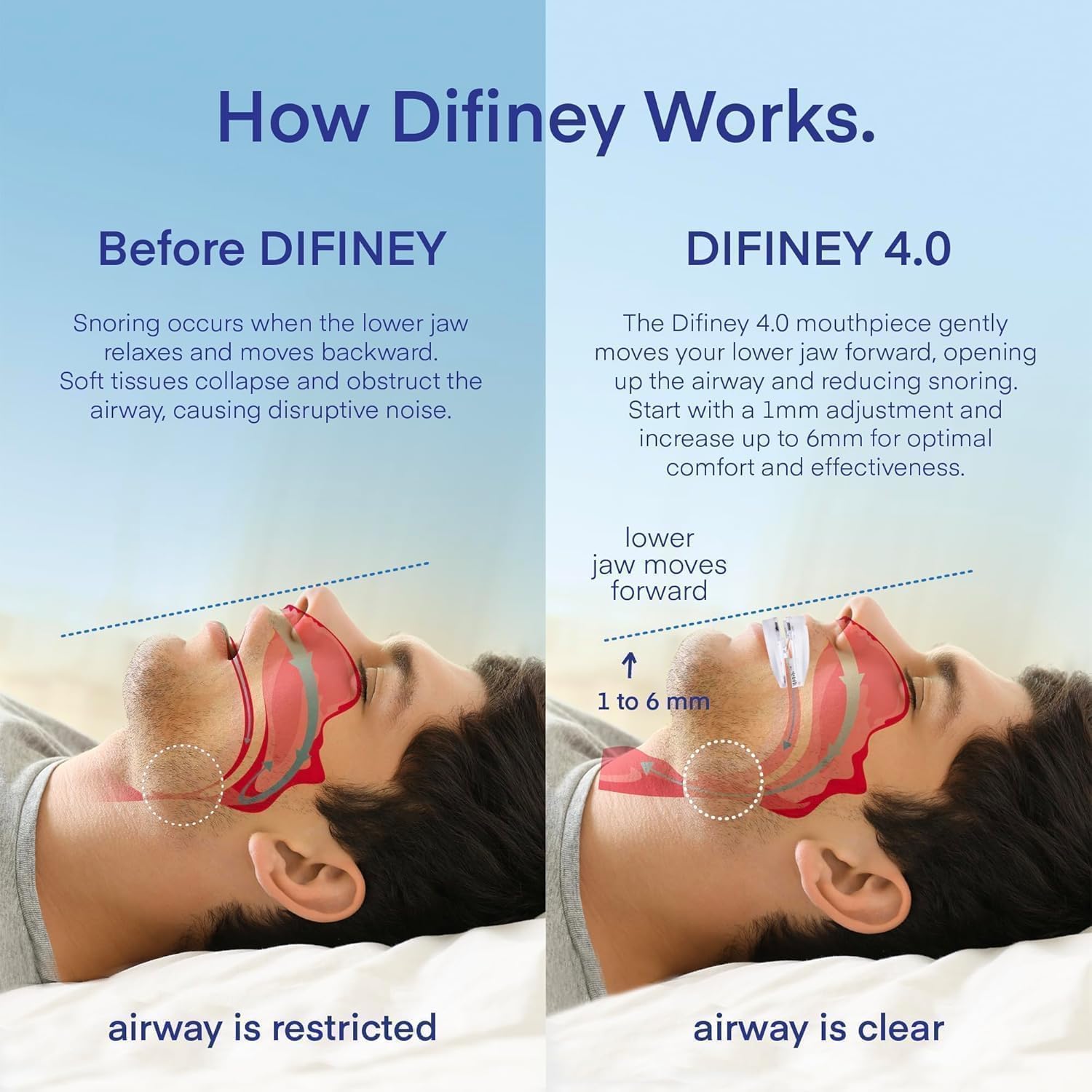 Difiney Advanced Anti Snoring Device 4.0: FDA-Cleared Snoring Solution – Adjustable Snore Stopper Mouth Guard for Men & Women – Anti Snoring Mouthpiece to Improve Sleep – Reusable Night Use Difiney Au supplements