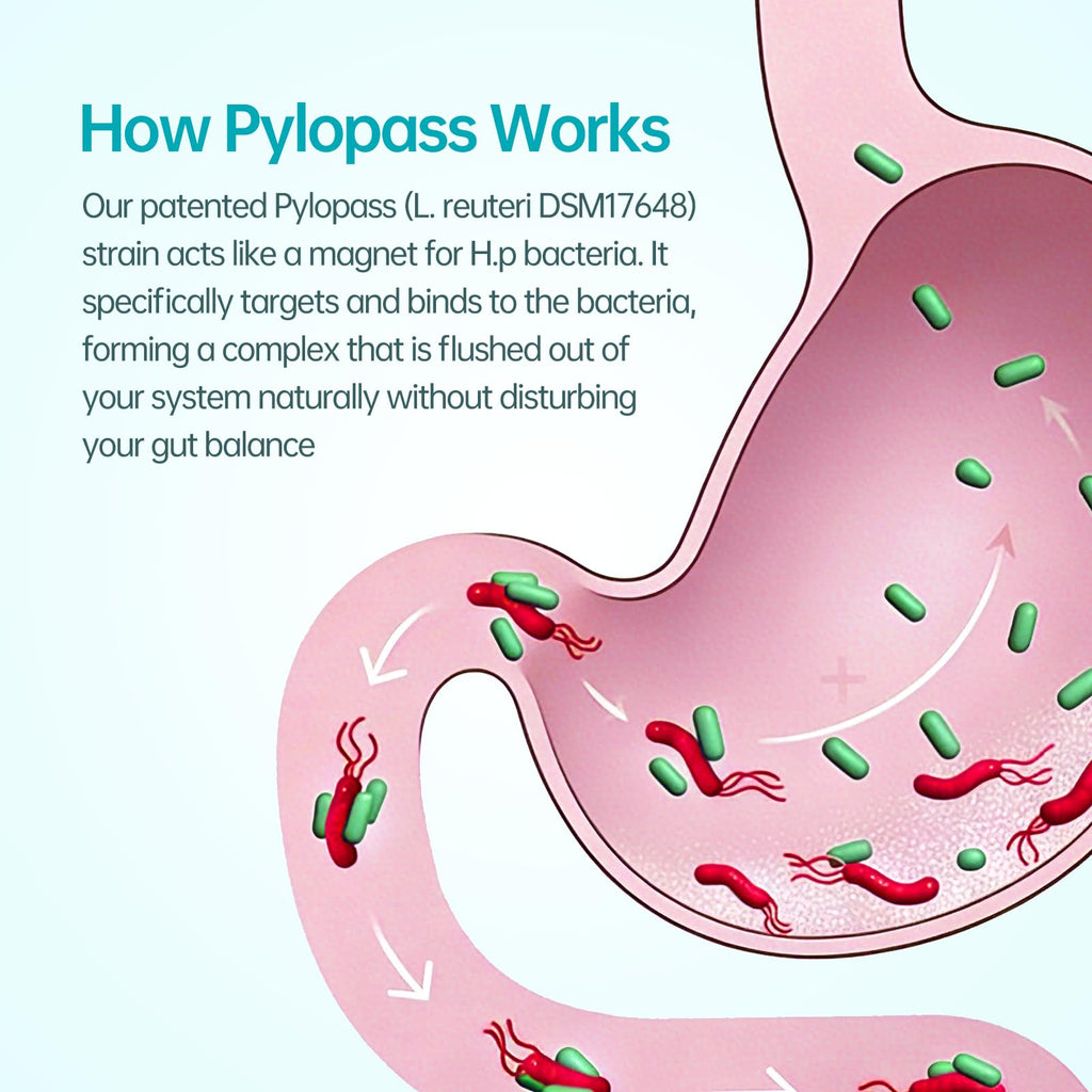 5-in-1 High Potency H. Pylori Probiotic, 1 Per Day - Supports Gastric Lining Integrity, Occasional Indigestion, Acid Comfort - Pylopass Lactobacillus Reuteri, Gluten Free, Vegan, 30ct, Made in Germany purmeo Au supplements