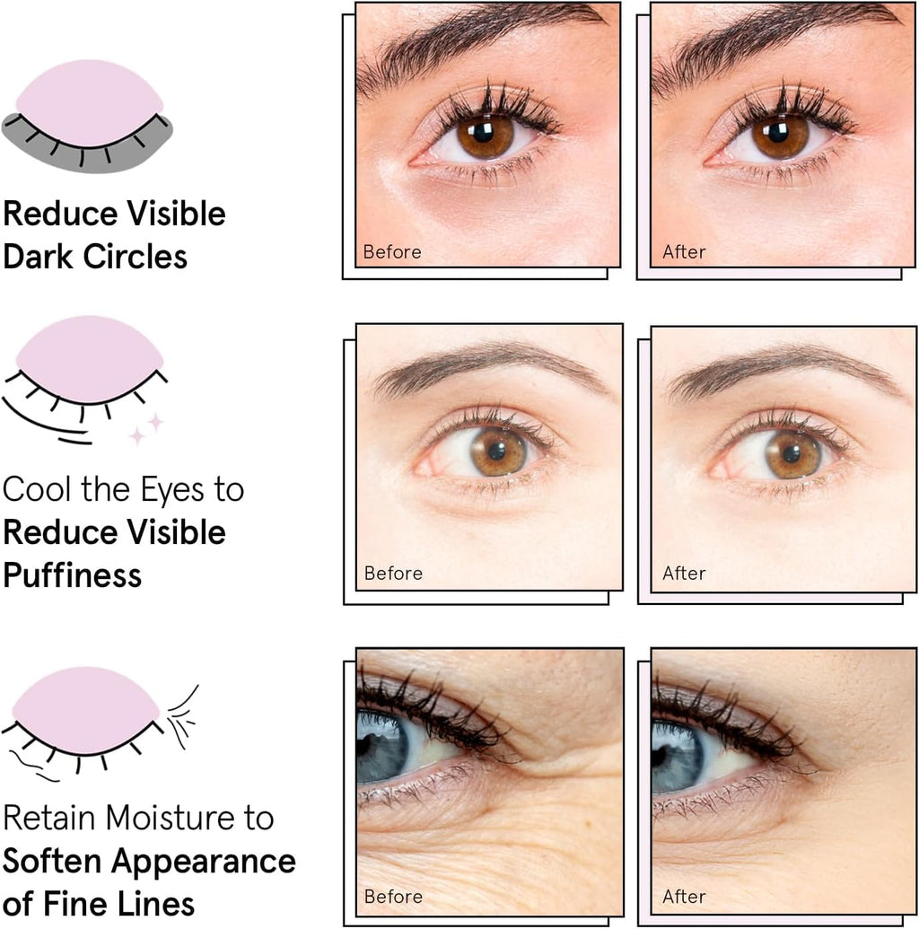 grace & stella Award Winning Under Eye Mask - Birthday Gifts for Women - Gel Eye Patches