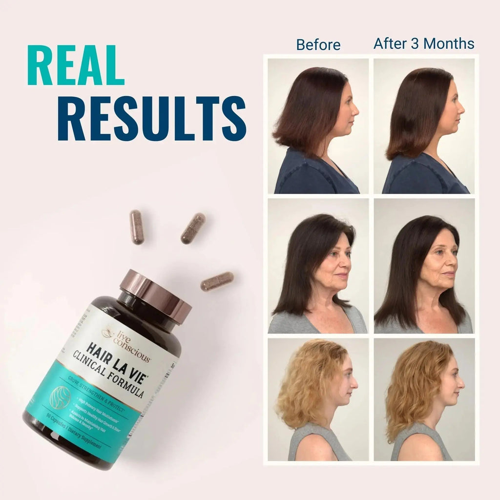 Hair La Vie Live Conscious Clinical Formula Hair Growth Vitamins for Women and Men w/Biotin, Collagen & Saw Palmetto (Pack of 1) Hair La Vie Au supplements