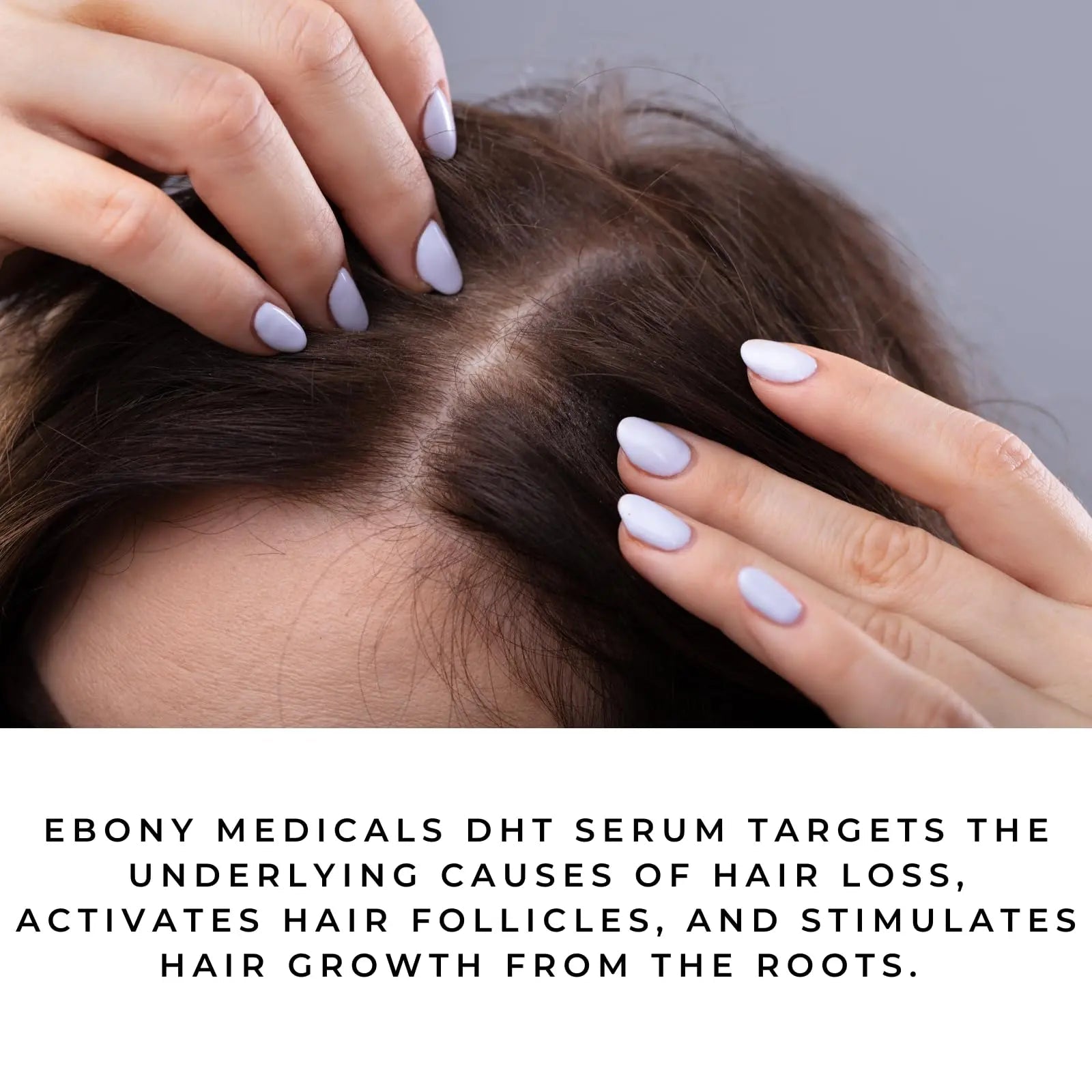Ebony Medicals DHT Blocker Hair Growth Serum - Hair Loss Supplement, Supports Natural Regrowth Natural Curves Au supplements