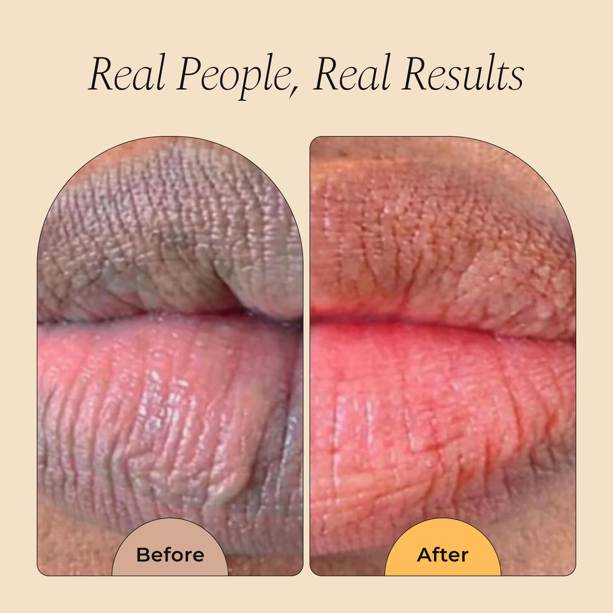 Glo Melanin All Natural Lemon and Turmeric Lip Balm - Natural Lip Balm Illuminate Your Smile