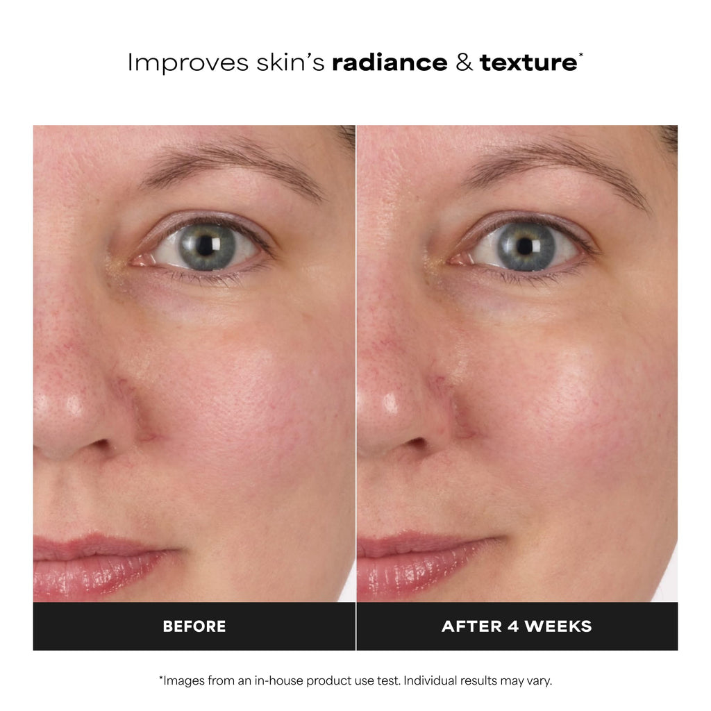 Paula's Choice Skin Balancing Pore-Reducing Face Toner with Niacinamide, for Oily Skin & Combination, Minimizes Large Pores,