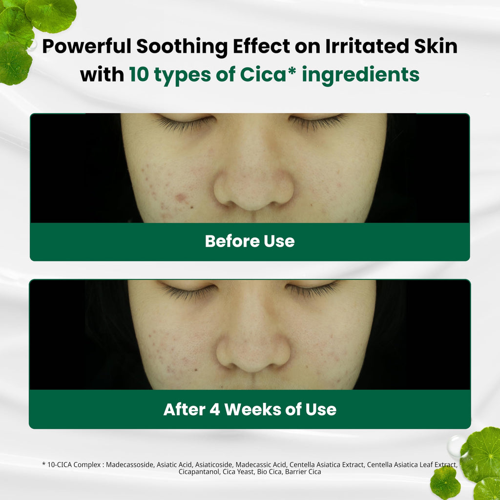 Dr. G R.E.D. Blemish Clear Soothing Cream - Calming Korean Moisturizer for Redness - Soothes Acne & Irritation