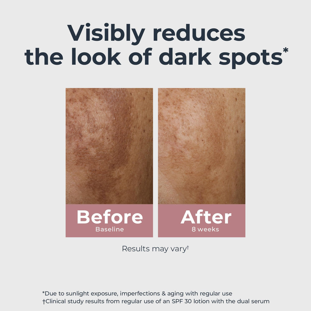 Eucerin Radiant Tone Dual Serum Dark Spot Corrector, Dark Spot Serum with Thiamidol