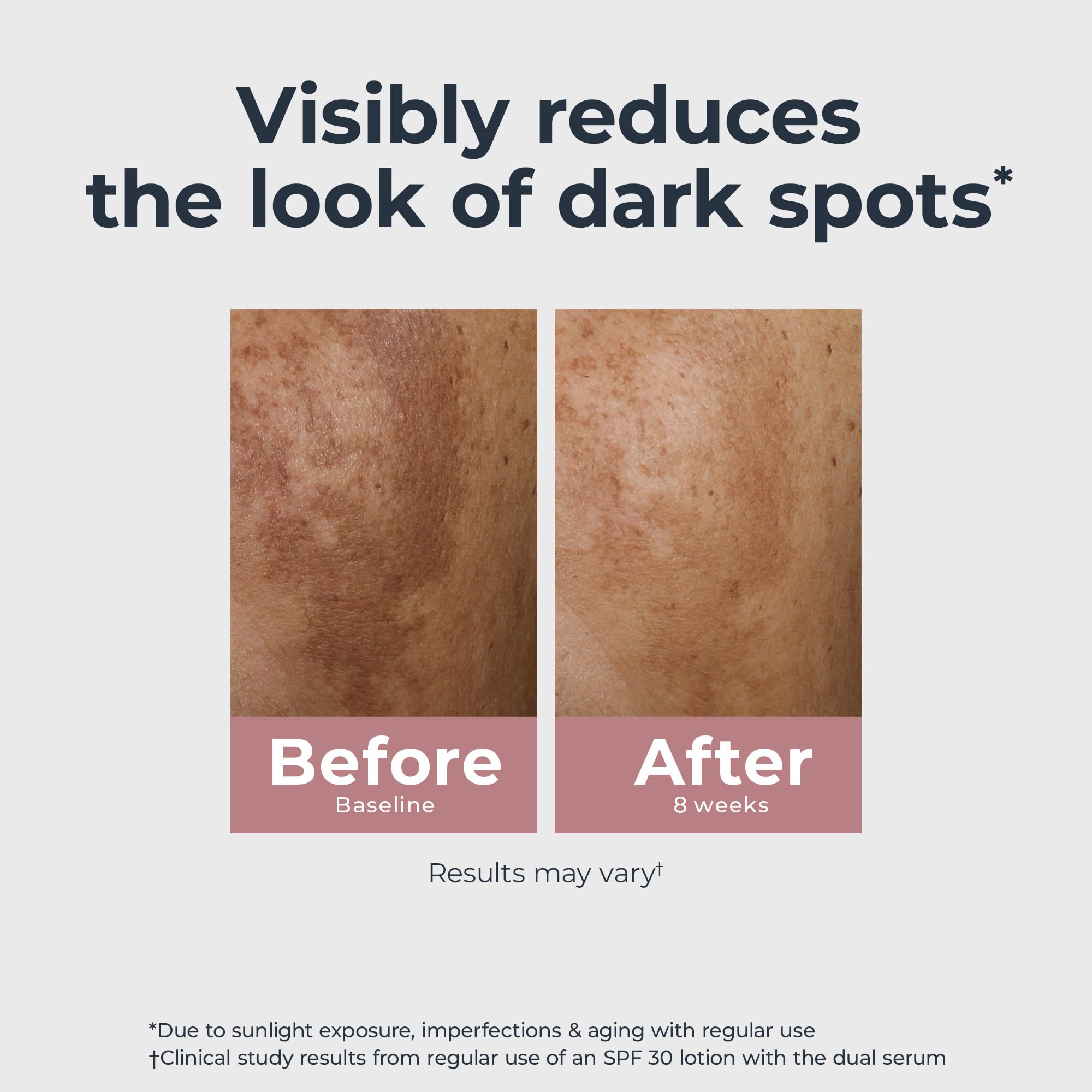 Eucerin Radiant Tone Dual Serum Dark Spot Corrector, Dark Spot Serum with Thiamidol