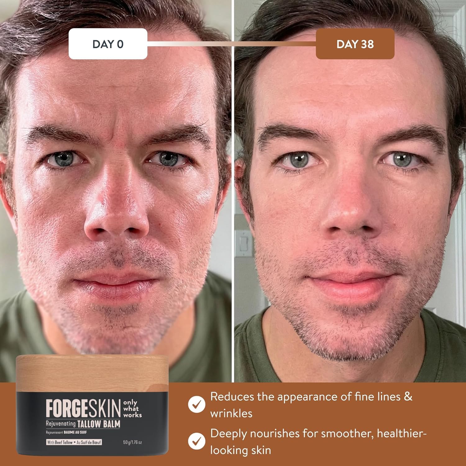 Forge Skin® Wrinkle Defense Beef Tallow Balm for Men [TALLOW-BASED] Moisturizer for Face Hydration - Hydrating Anti Aging Skin Cream