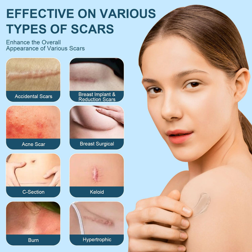 Mitgary Advanced Scar Gel, Silicone Scar Gel, Treats Old and New Scars, Reduces the Appearance of Scars from, Body, Face, Stretch Marks