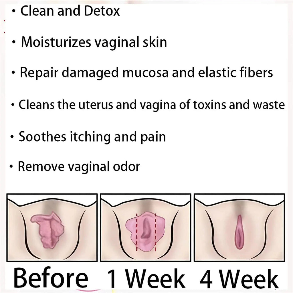AnnieCare Instant Anti-Itch Detox Slimming Products, Annie Care Natural Detox Viginal Gel DASHENRAN Au supplements