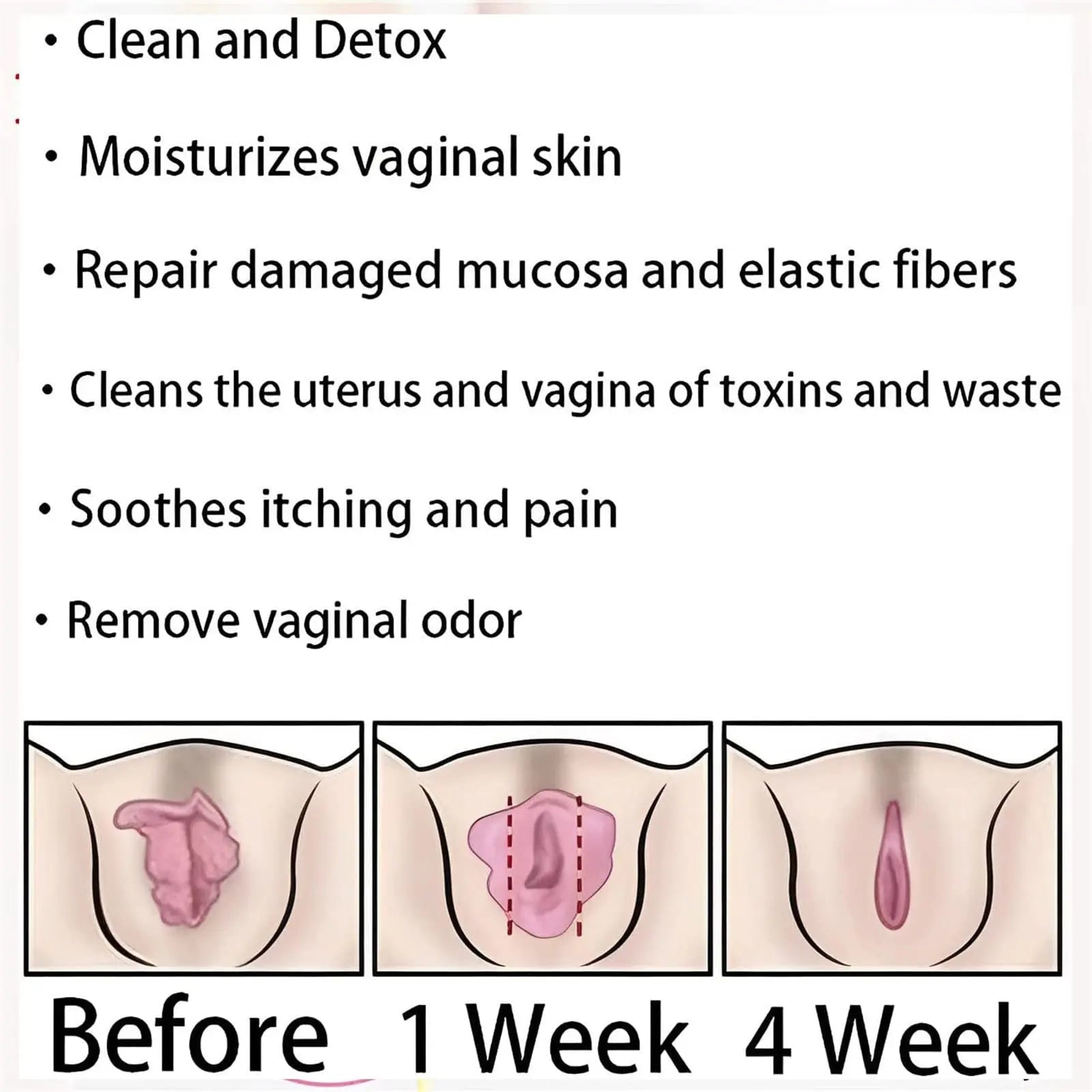 AnnieCare Instant Anti-Itch Detox Slimming Products, Annie Care Natural Detox Viginal Gel DASHENRAN Au supplements