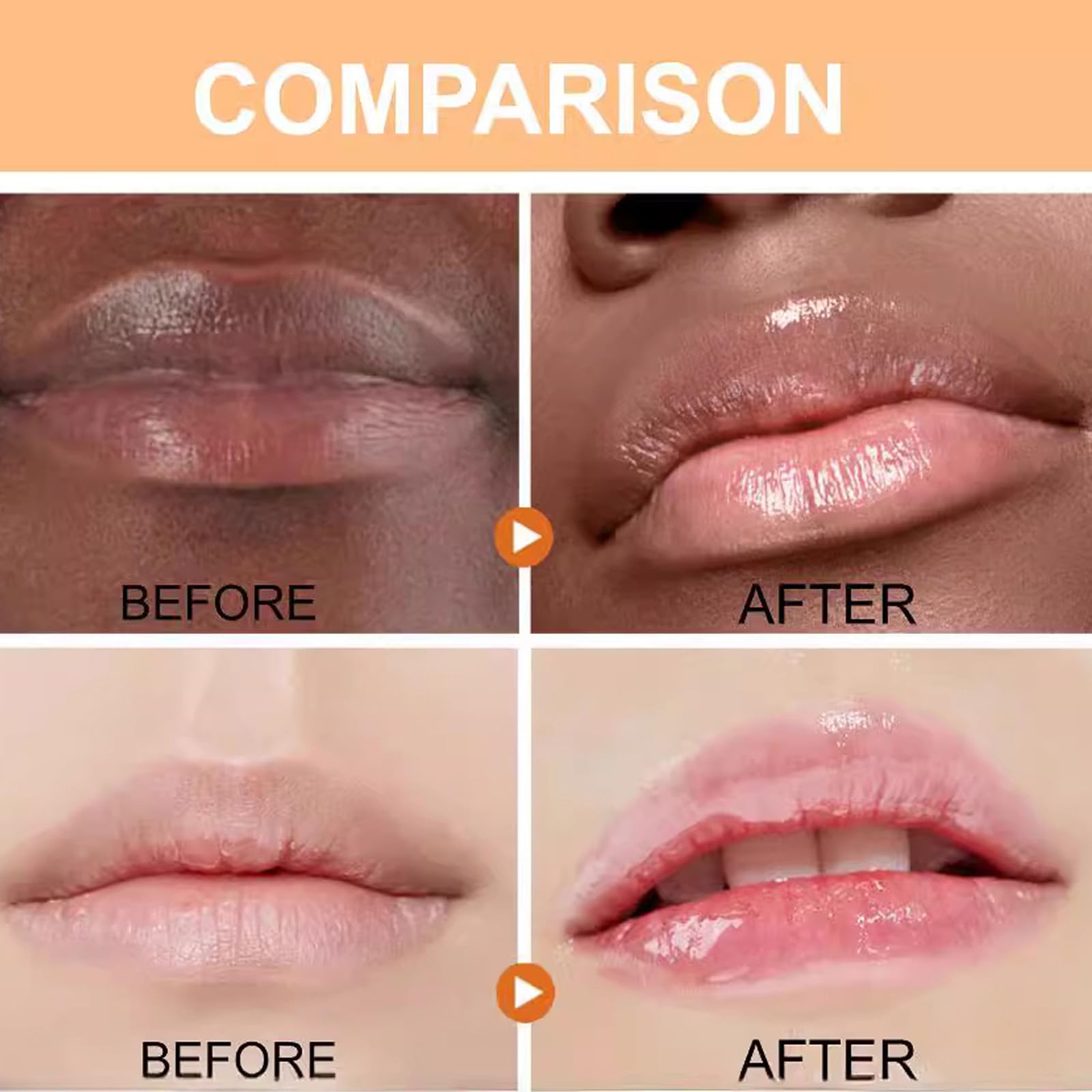 Turmeric Lip Balm for Smokers With Root Oil - Brightening for Dark Lips, Long-Lasting Moisturizer for Dry