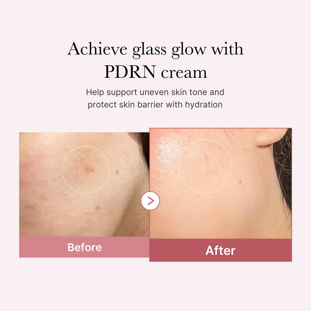 medicube PDRN Pink Hyaluronic Moisturizing Cream | Blemish Recovery, Relief & Hydrating Care | Restores Skin Elasticity & Glow