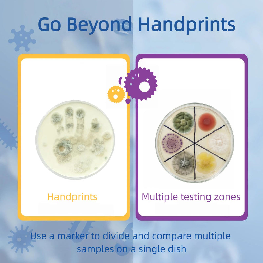 Giant Microbiology Bacteria Science Kit for Kids:2 XL 150mm Prepoured Nutrient Agar Plates, Petri Dishes with Agar & Colony Characteristics Poster for School Projects & Educational Gifts Mosynex Au supplements