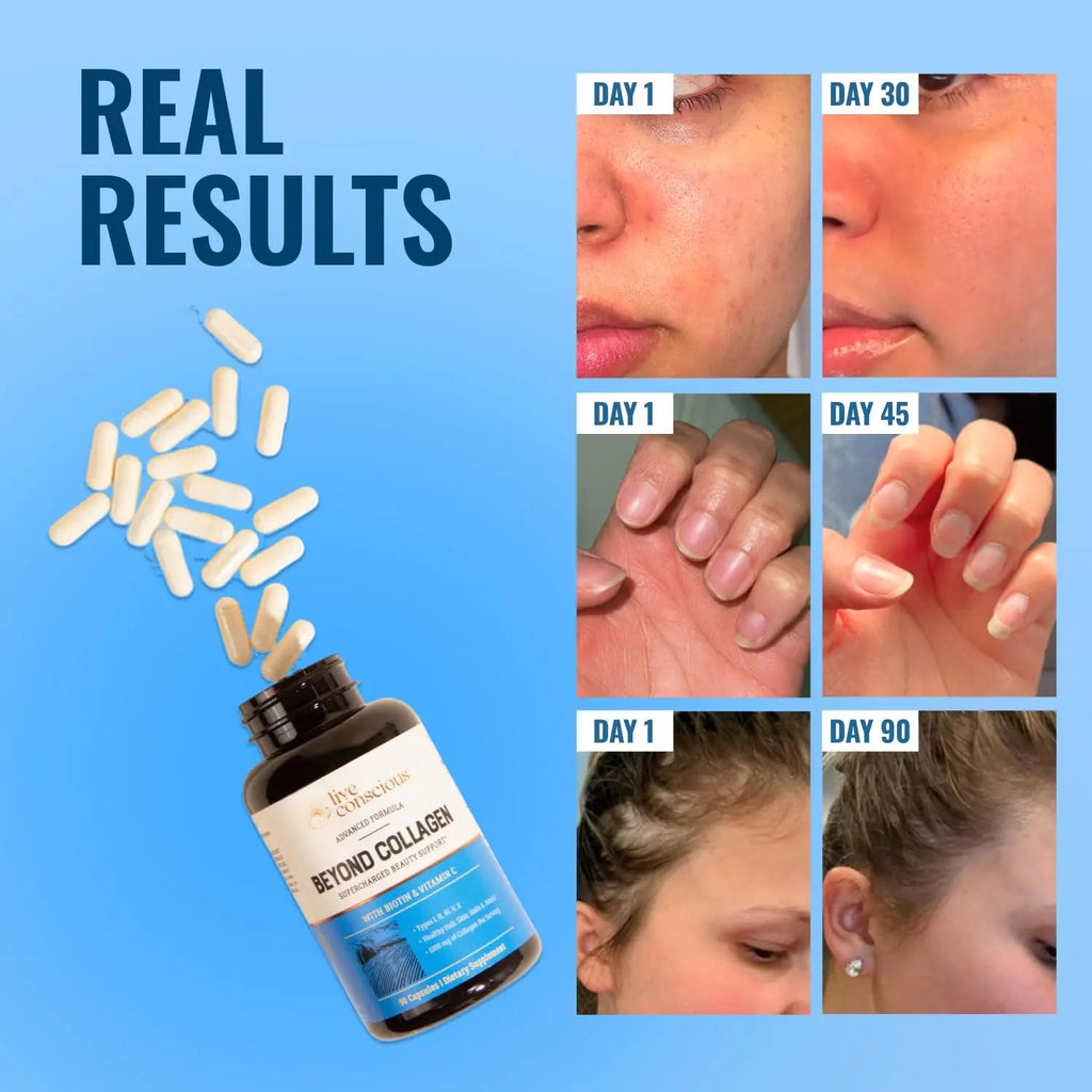 Live Conscious Beyond Collagen Multi Collagen Capsules - Types I, II, III, V & X - Hydrolyzed Blend with Biotin & Vitamin C Live Conscious Au supplements