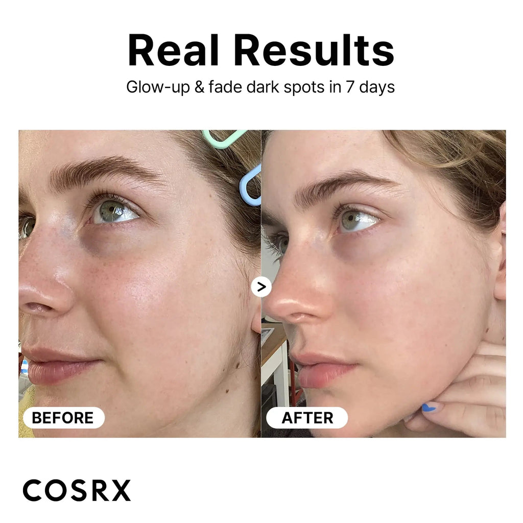 COSRX Pure Vitamin C Serum with Vitamin E & Hyaluronic Acid, Brightening COSRX Au supplements