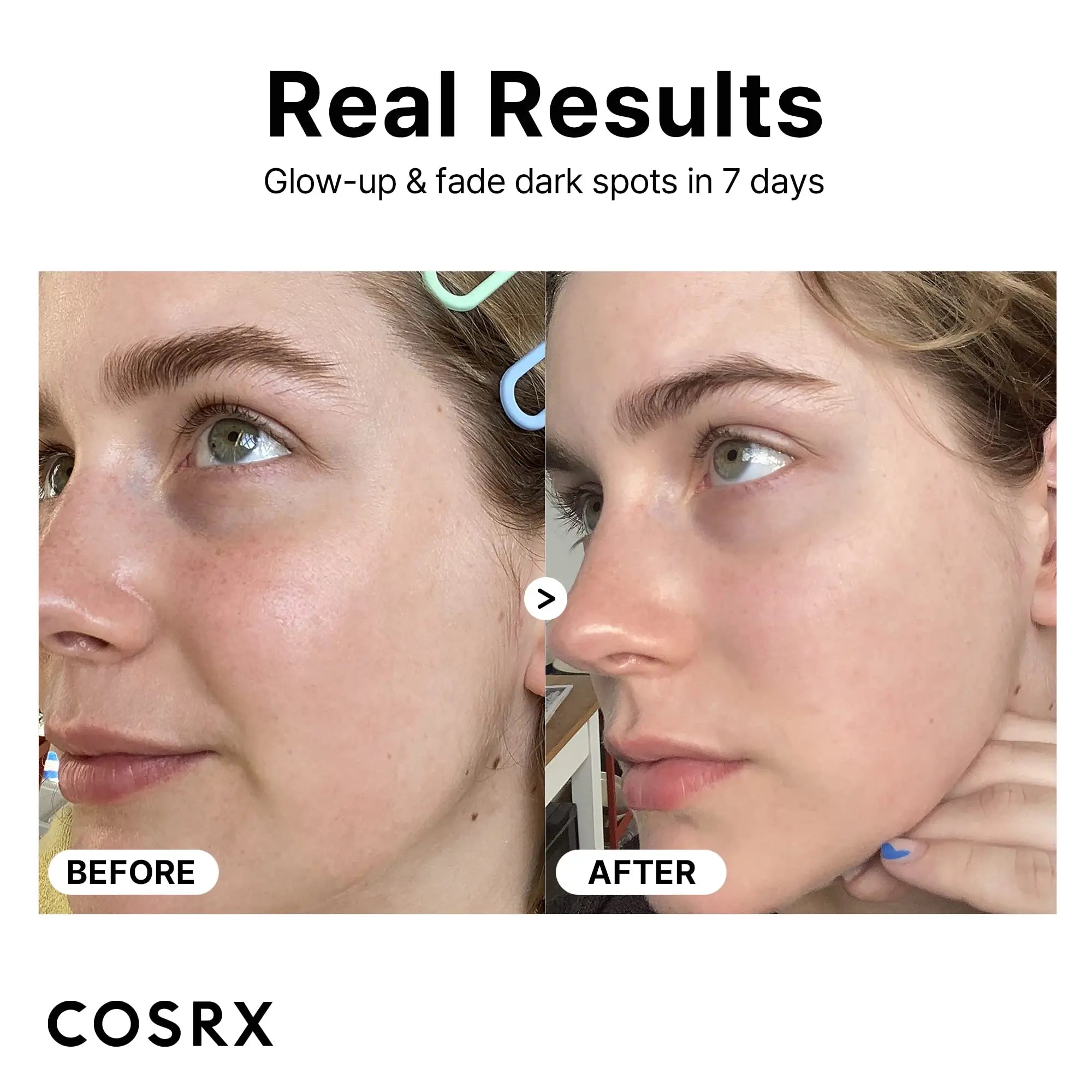 COSRX Pure Vitamin C Serum with Vitamin E & Hyaluronic Acid, Brightening COSRX Au supplements