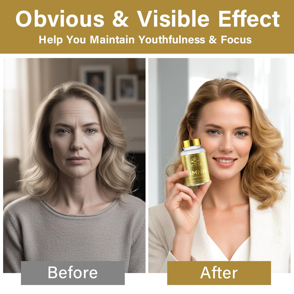 120 Capsules-NMNH (Dihydronicotinamide Mononucleotide), NAD Supplement to Boost NAD+ Levels as We Age (May Be More Effective Than Nicotinamide Riboside), NMNH Supplement for Anti-Aging VVQ Au supplements