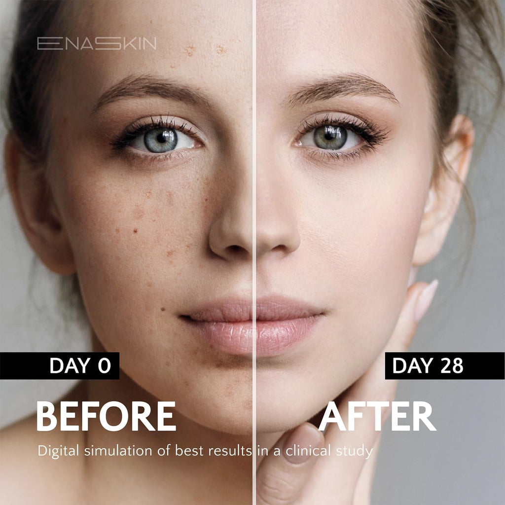 Enaskin Dark Spot Set - Serum & Soap Bars: Hyperpigmentation Body Treatment for Freckles Melasma Age Spot Sun Spot - Dark Spots Corrector Serum