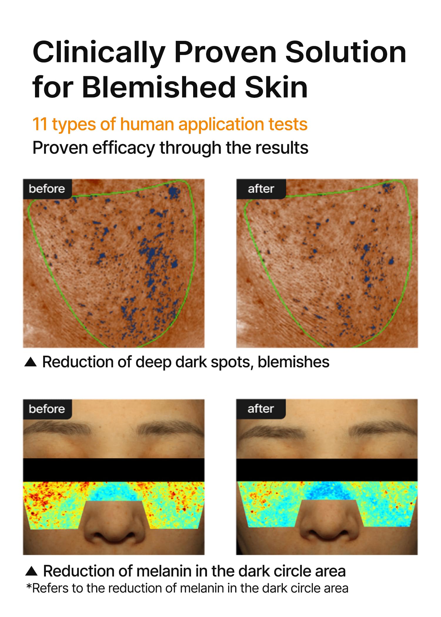 celimax Pore+Dark Spot Brightening Cream | with Niacinamide, Tranexamic Acid, TXA Cream