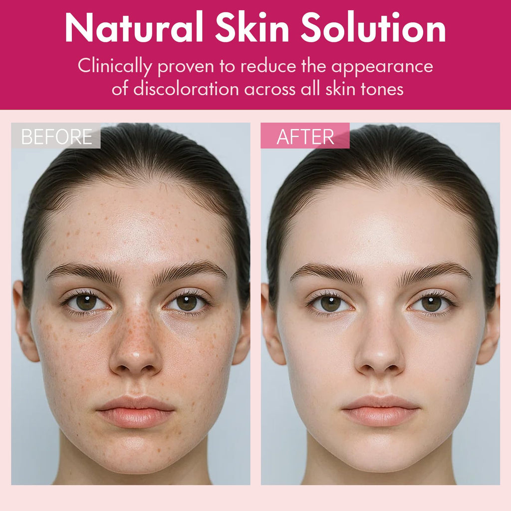 Roseblem Arbutin 7% + Tranexamic Acid 4% Face Cream for Dark Spots & Uneven Skin Tone