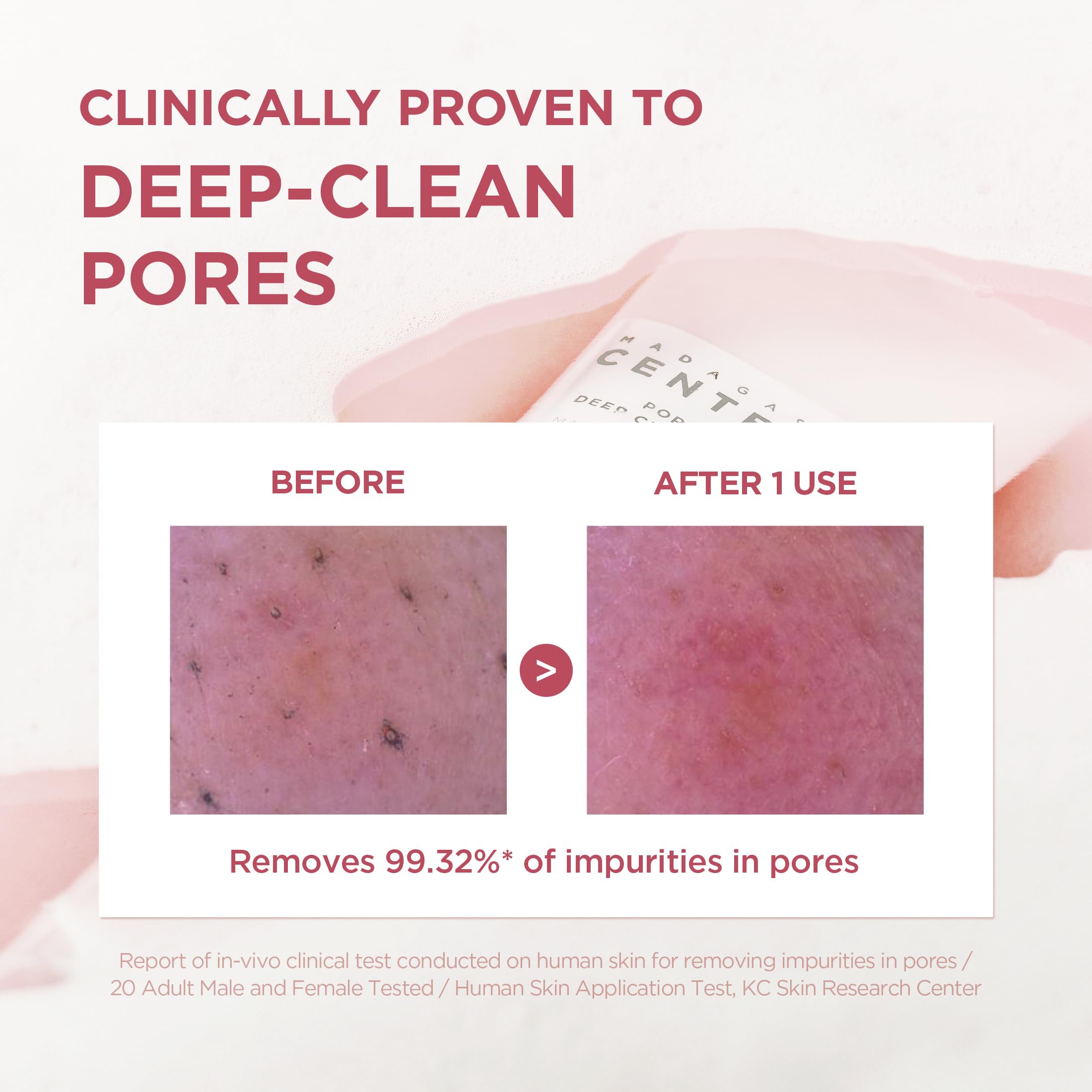 SKIN1004 Poremizing Deep Cleansing Foam, 4.23 fl.oz, 125ml, Makeup Remover, Korean Face Cleanser with Himalayan Pink Salt