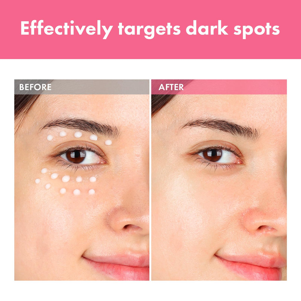 TOSOWOONG Arbutin 7% Intensive Spot Cream with 70,000ppm Arbutin, 3% Tranexamic Acid, 1% Niacinamide, Glutathione, Dark Spots