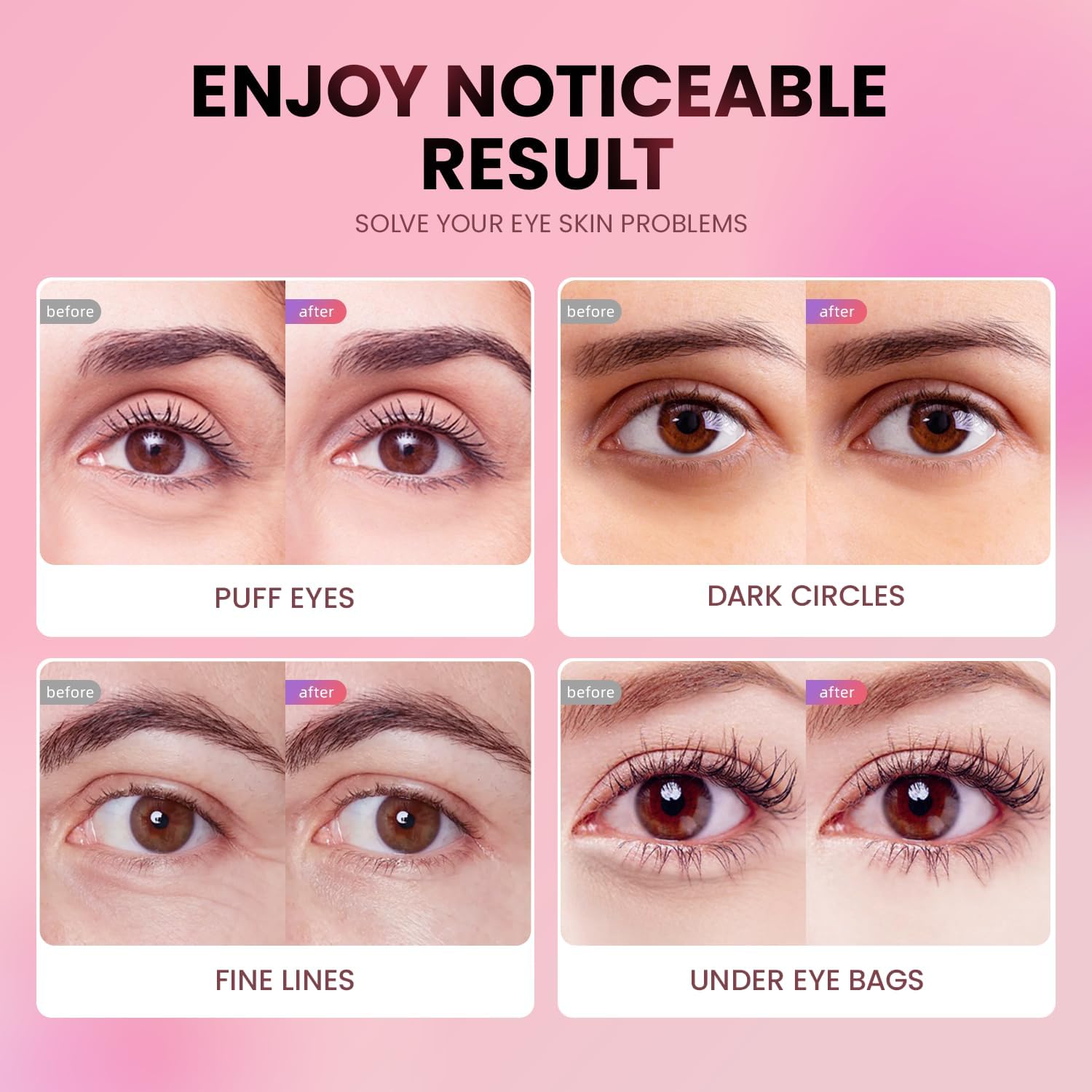 AILEORY Under Eye Patches (24 Pairs) - Tri-color Glitter Eye Gel Pads for Dark Circles, Puffy Eyes, Under eye Bags, Wrinkles