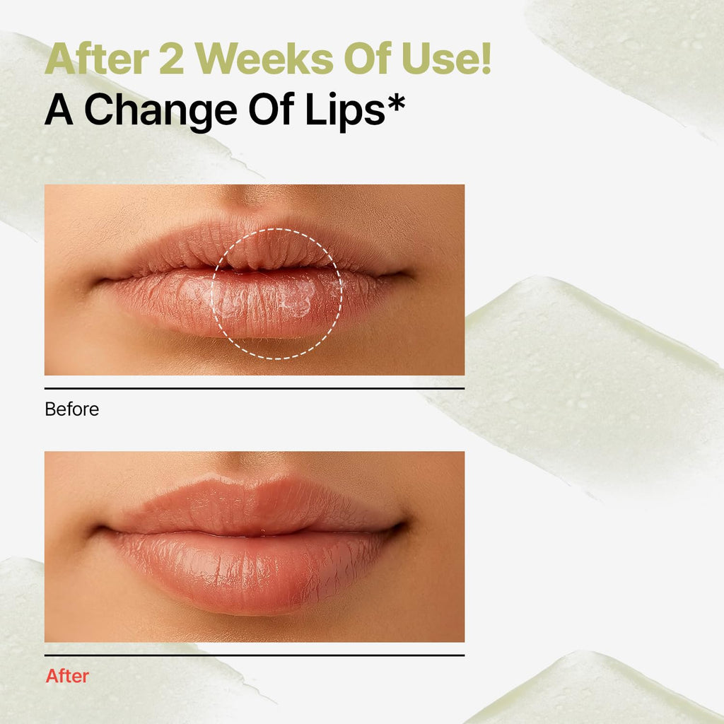 Dr.Different Retinal Lip Balm Clear, Anti-Wrinkle Lip Treatment with Deep Hydration
