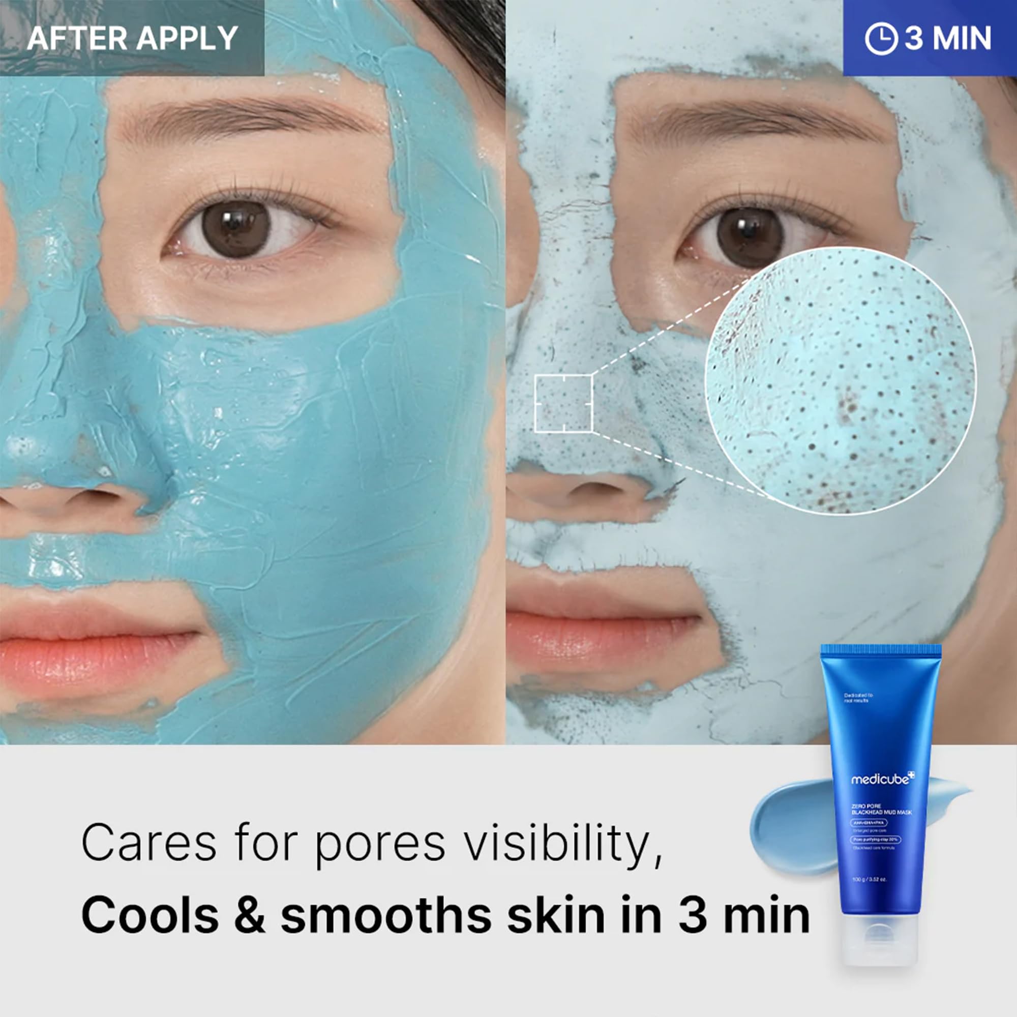 Medicube Zero Pore Blackhead Mud Facial Mask - Skin Cooling & Pore Tightening - 3 Minute Quick Dry Formula with AHA, BHA, PHA