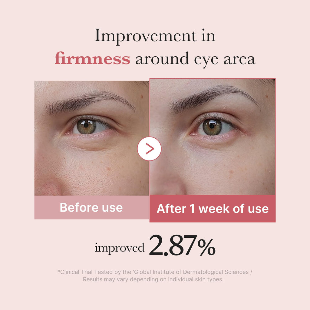 medicube Eye Serum with Salmon DNA PDRN & Pink Peptides | 99% Purity Retinol for Fine Lines