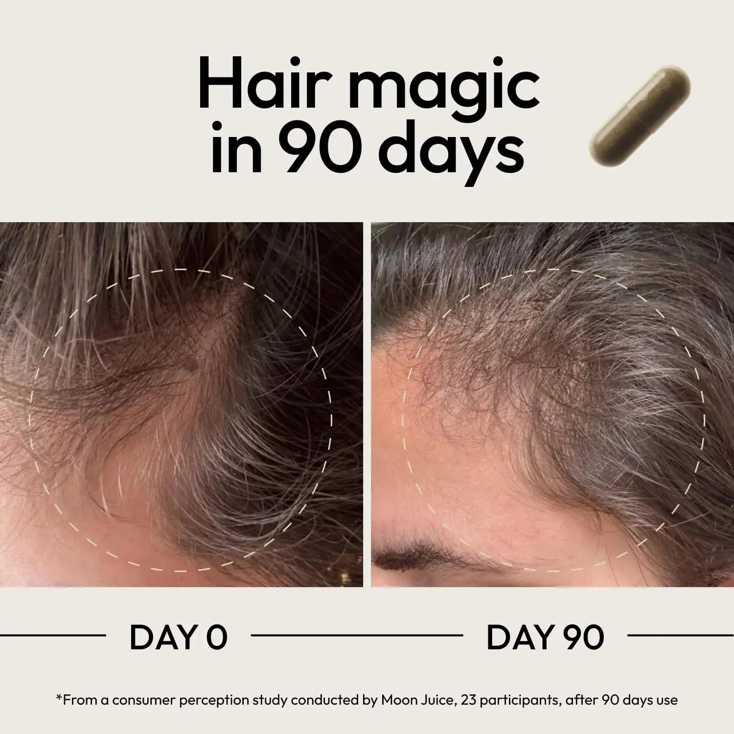 Moon Juice SuperHair Hair Growth Vitamins for Women & Men with Biotin & Saw Palmetto - Clinical Strength Multivitamin Hair Supplement Moon Juice Au supplements