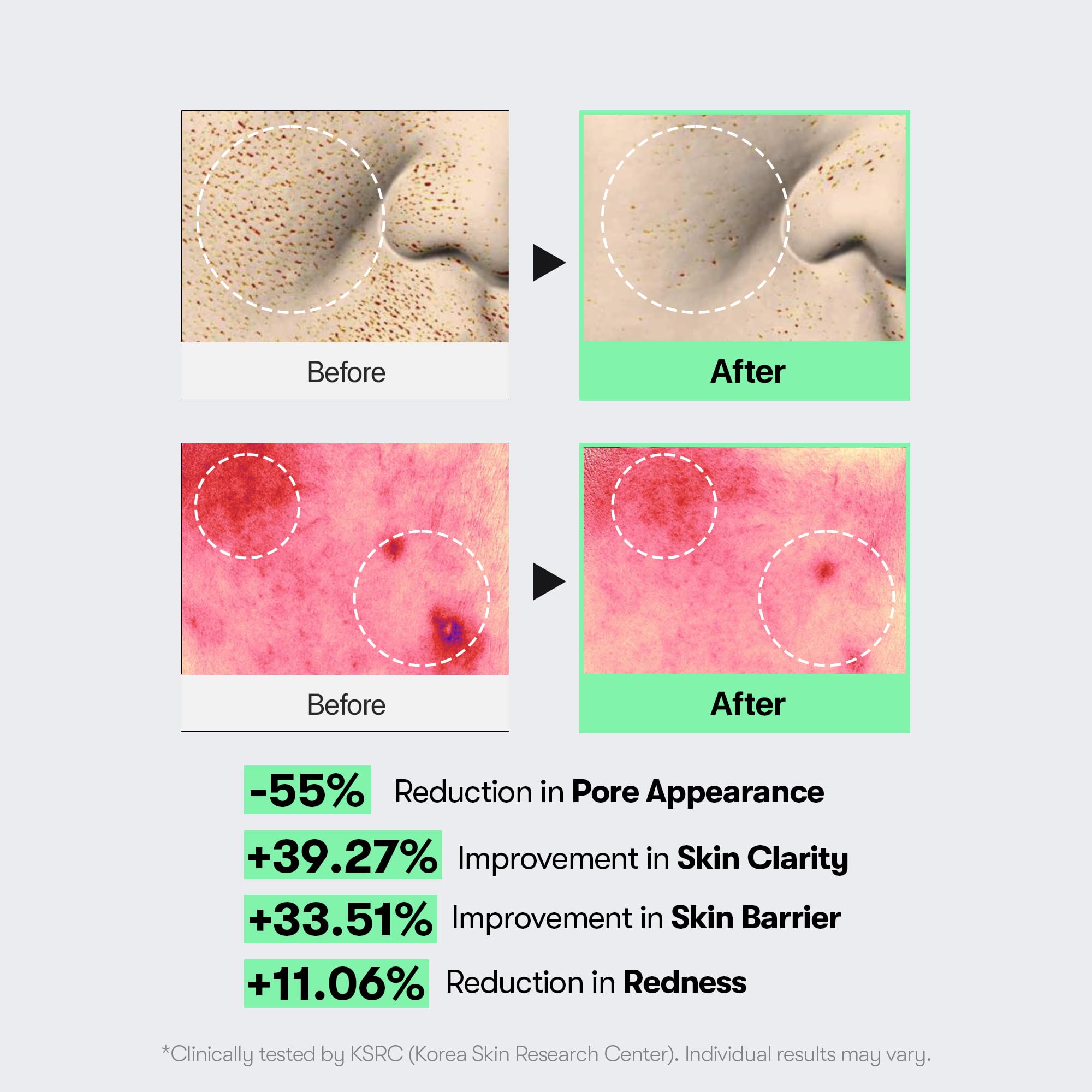 VT COSMETICS CICA Reedle Shot 100, Spicule Microneedling Serum for Pore Care & Exfoliation, Exosome, Centella Asiatica for Glass Skin