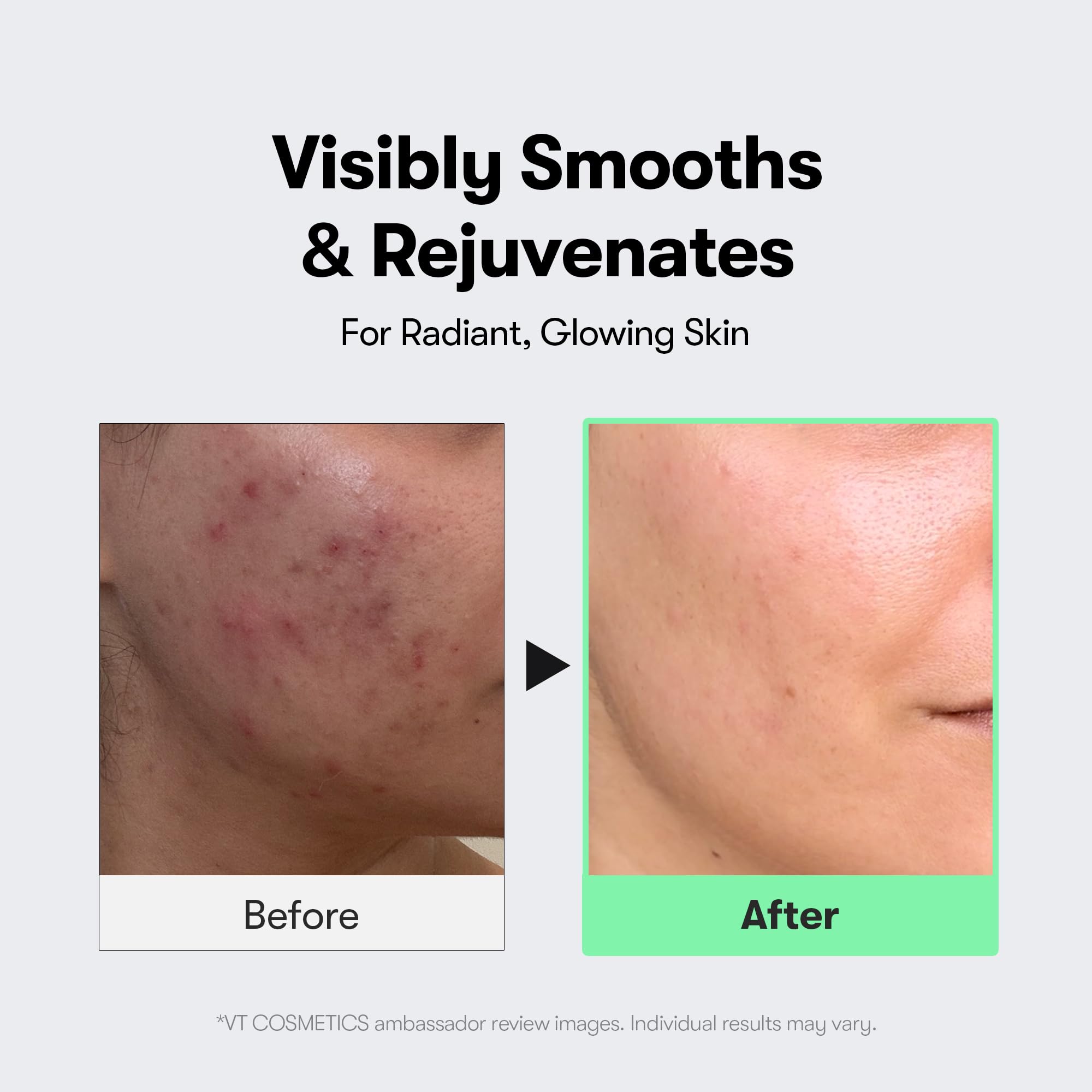 VT COSMETICS CICA Reedle Shot 100, Spicule Microneedling Serum for Pore Care & Exfoliation, Exosome, Centella Asiatica for Glass Skin