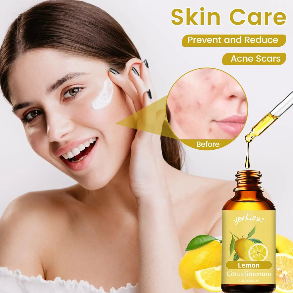 yethious Lemon Essential Oil Lemon Essential Oill for Diffuser, Perfume, Body, Skin, Hair, Candle Soap yethious Au supplements