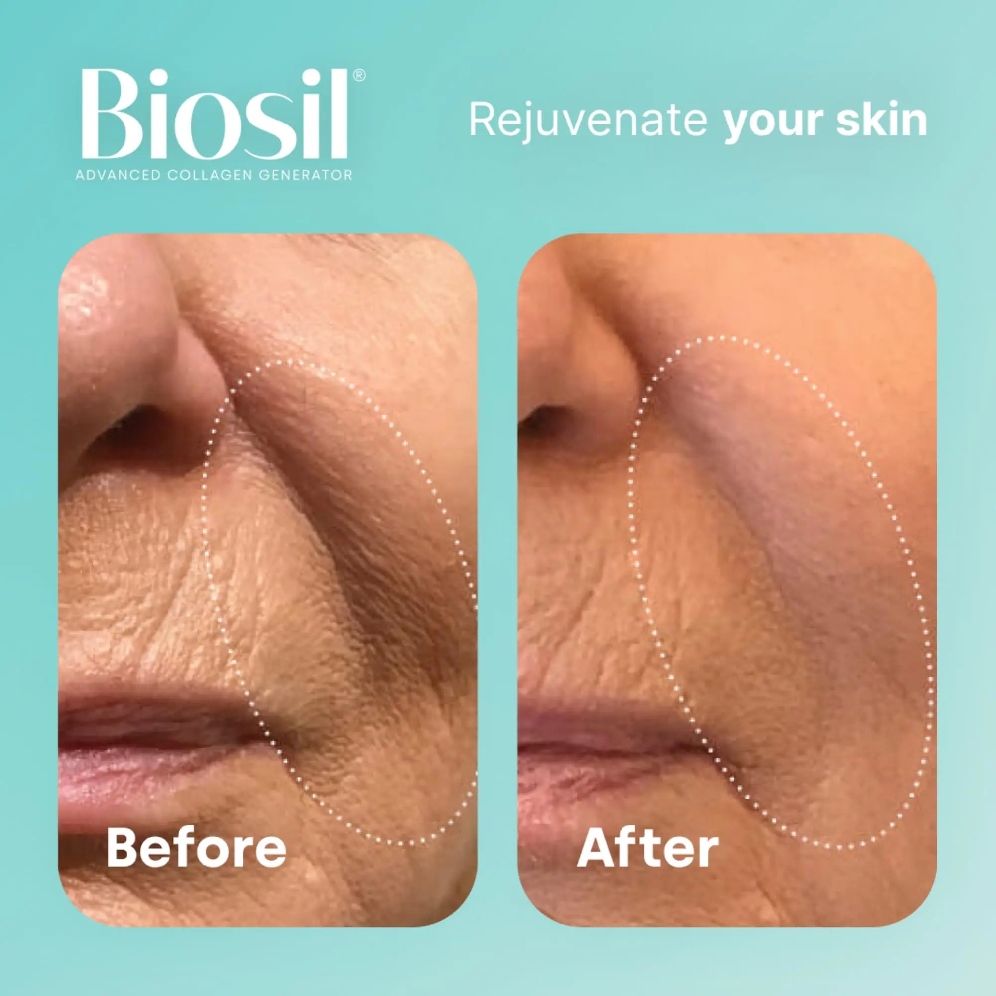 Biosil Collagen Generator - 30 mL Drops - with Patented ch-OSA Complex BioSil Au supplements