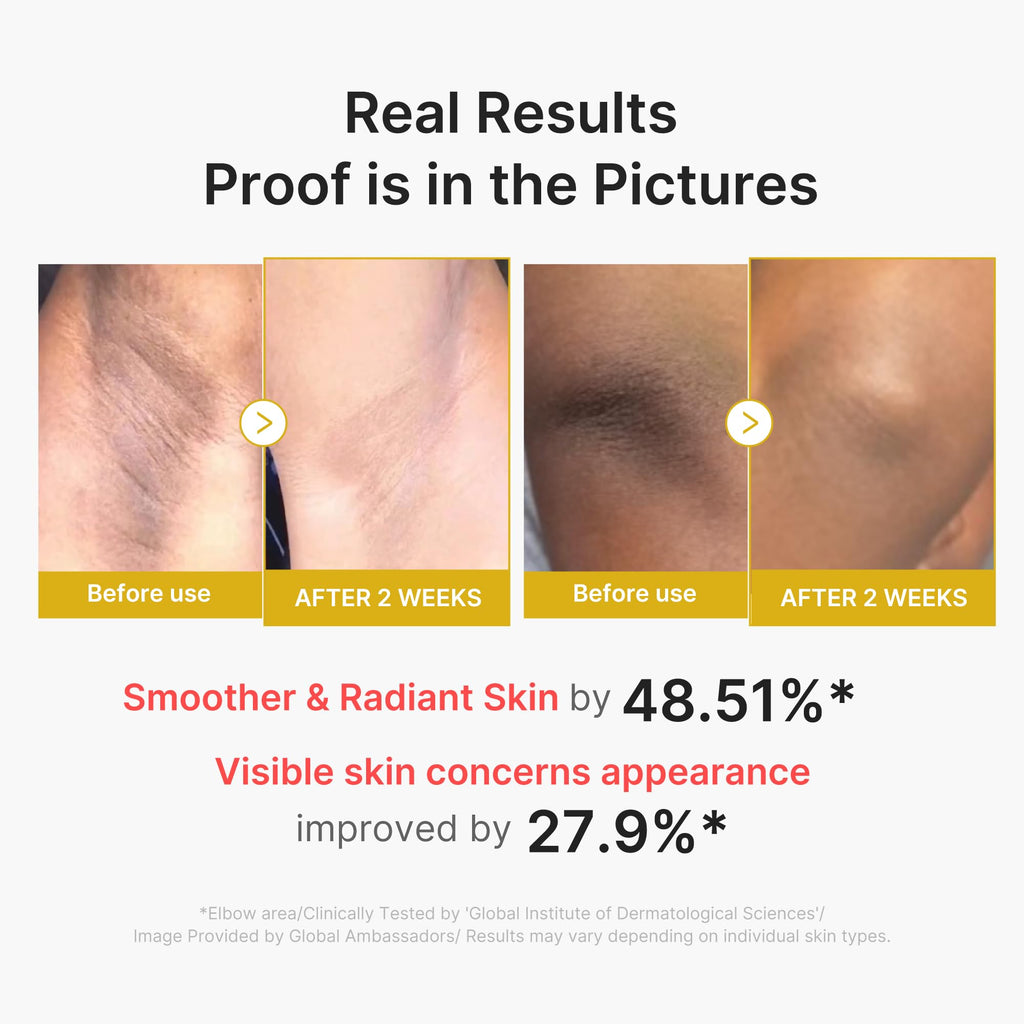 medicube Body Peel Shot with Kojic Acid and Turmeric | Gentle Body Brightening & Exfoliating Serum with BHA, LHA & PHA for Dead Skin Cells