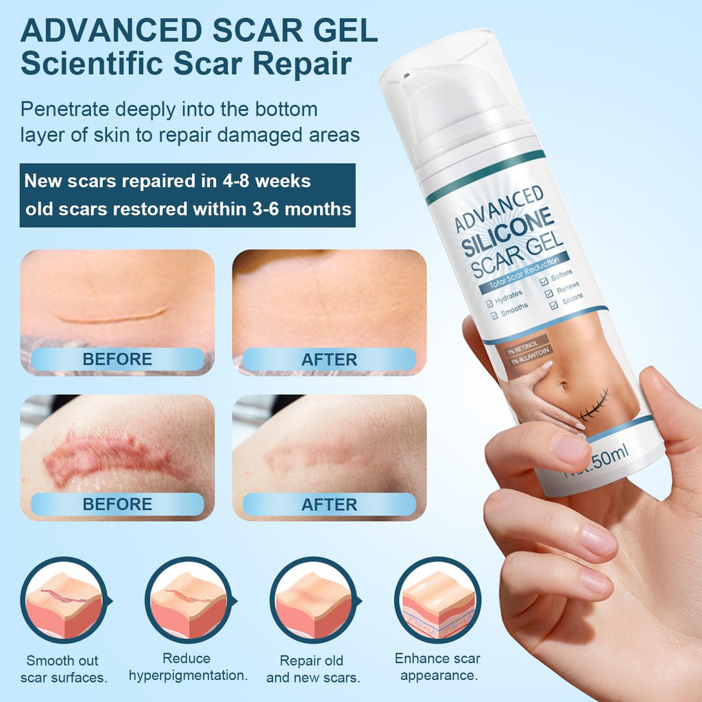 Mitgary Advanced Scar Gel, Silicone Scar Gel, Treats Old and New Scars, Reduces the Appearance of Scars from, Body, Face, Stretch Marks